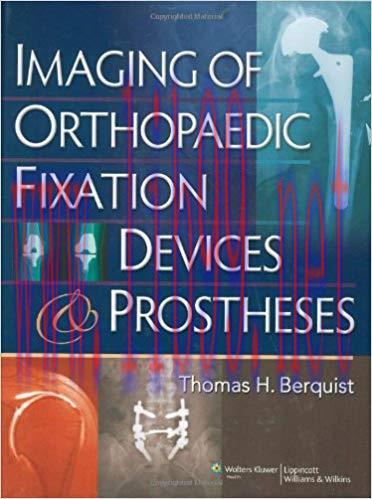 [PDF]Imaging of Orthopaedic Fixation Devices and Prostheses