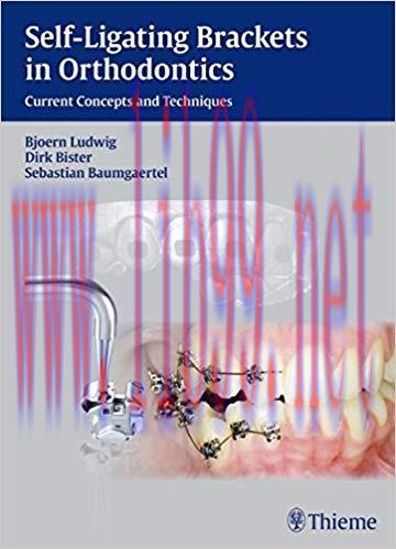 [PDF]Self-ligating Brackets in Orthodontics