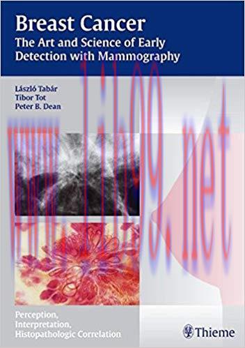 [PDF]Breast Cancer - The Art and Science of Early Detection with Mammography , 1e [Thieme] [2004]