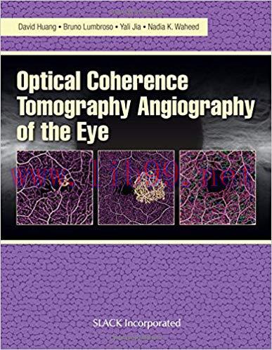 [PDF]Optical Coherencre Tomography Angiography of the Eye
