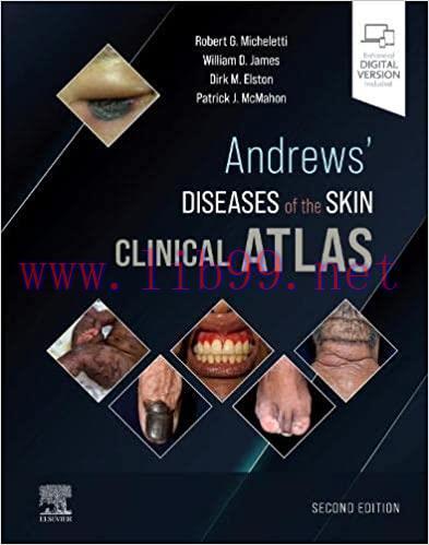 [PDF]Andrews’ Diseases of the Skin Clinical Atlas 2nd Edition