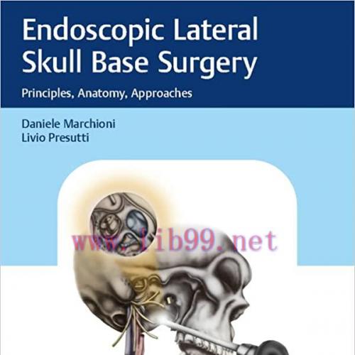 [PDF]Endoscopic Lateral Skull Base Surgery Principles, Anatomy, Approaches PDF