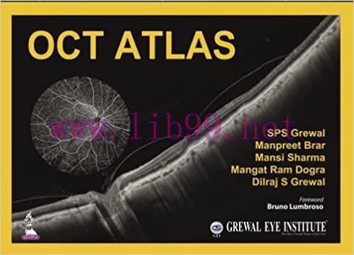 [PDF]OCT Atlas