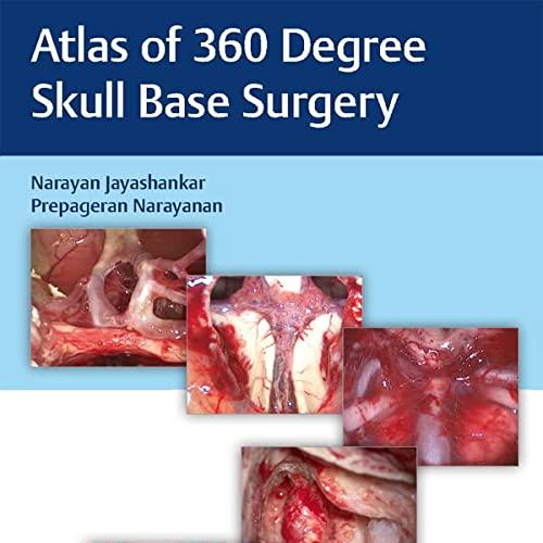 Atlas of 360 degrees Skull Base Surgery-AK