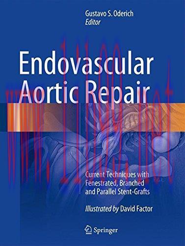 [AME]Endovascular Aortic Repair: Current Techniques with Fenestrated, Branched and Parallel Stent-Grafts (PDF)