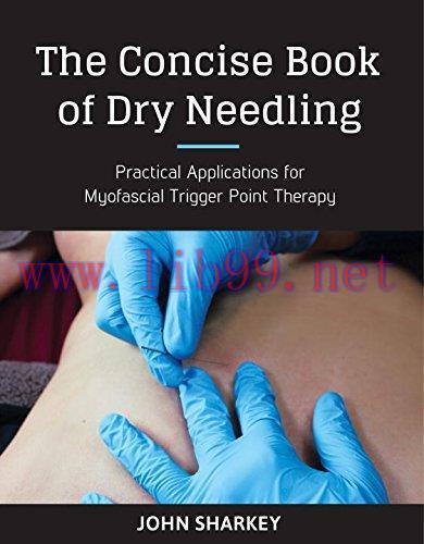 [AME]The Concise Book of Dry Needling: A Practitioner's Guide to Myofascial Trigger Point Applications (EPUB)