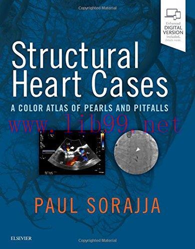 [AME]Structural Heart Cases: A Color Atlas of Pearls and Pitfalls, 1e (PDF)