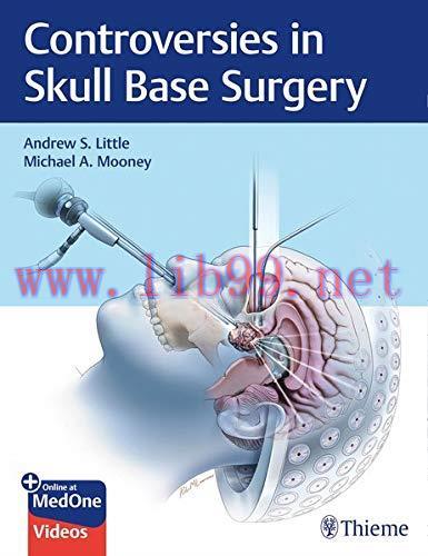 [AME]Controversies in Skull Base Surgery (PDF)