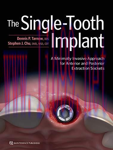 [AME]The Single-Tooth Implant: A Minimally Invasive Approach for Anterior and Posterior Extraction Sockets