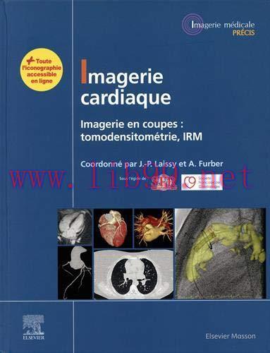 [AME]Imagerie cardiaque: Imagerie en coupes : scanner, IRM (Imagerie médicale : Précis) (French Edition) (True PDF Publisher Quality)