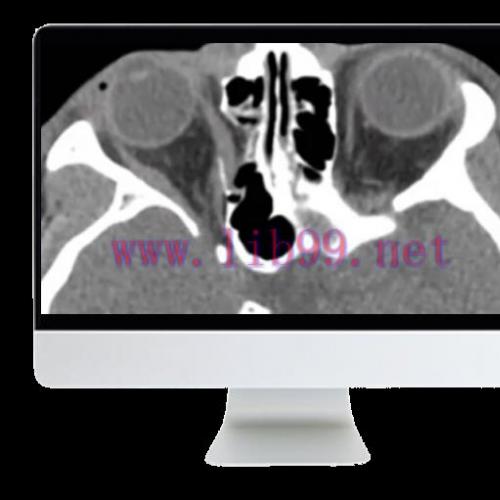 [AME]ARRS Imaging Victims of Violence: Fists, Stabs, Bullets, and Blasts 2021 (CME VIDEOS)