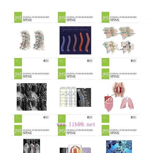 [AME]Journal of Neurosurgery: Spine 2021 Full Archives (True PDF)