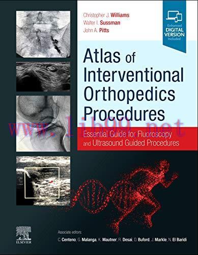 [PDF]Atlas of Interventional Orthopedics Procedures: Essential Guide for Fluoroscopy and Ultrasound Guided Procedures (Original PDF)