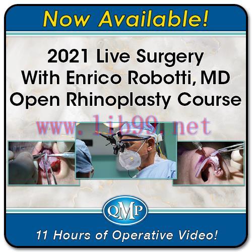 [AME]2021 Live Surgery With Enrico Robotti, MD Open Rhinoplasty Course (CME VIDEOS)