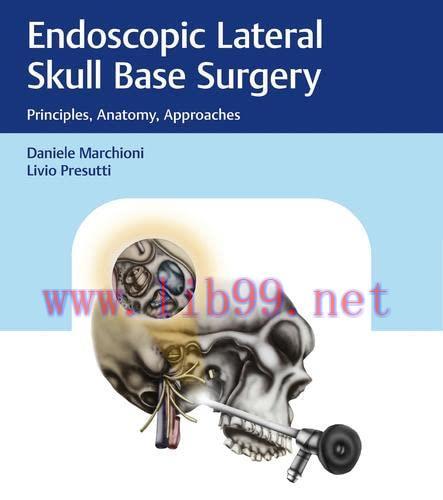 [AME]Endoscopic Lateral Skull Base Surgery: Principles, Anatomy, Approaches (Original PDF+Videos)
