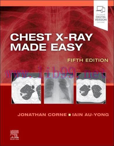 [AME]Chest X-Ray Made Easy, 5th edition (Original PDF)