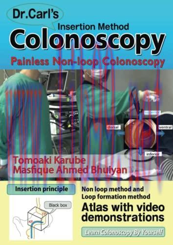 [AME]Dr. Carl’s Colonoscopy insertion method: Painless Non-loop Colonoscopy (AZW 3 + EPUB + Converted PDF)