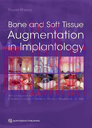 [PDF]Bone and Soft Tissue Augmentation in Implantology (Original PDF)