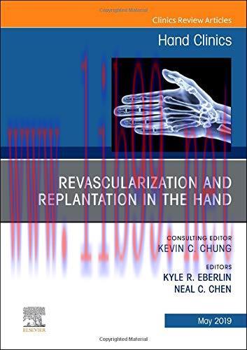 [AME]Revascularization and Replantation in the Hand, An Issue of Hand Clinics (Volume 35-2) (The Clinics: Orthopedics, Volume 35-2) (Original PDF)