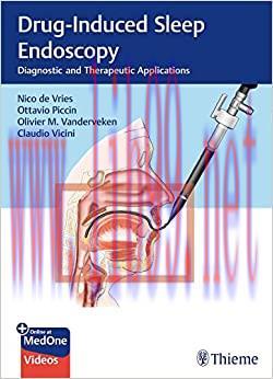 [AME]Drug-Induced Sleep Endoscopy: Diagnostic and Therapeutic Applications (EPUB)