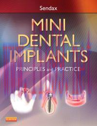 [AME]Mini Dental Implants: Principles and Practice (Original PDF)