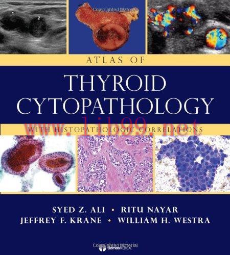 [AME]Atlas of Thyroid Cytopathology: With Histopathologic Correlations (Original PDF)