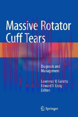 [AME]Massive Rotator Cuff Tears: Diagnosis and Management