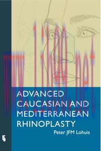 [AME]Advanced Caucasian and Mediterranean Rhinoplasty
