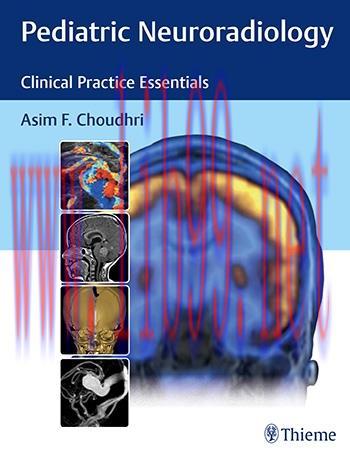 [AME]Pediatric Neuroradiology: The Essentials (Original PDF)