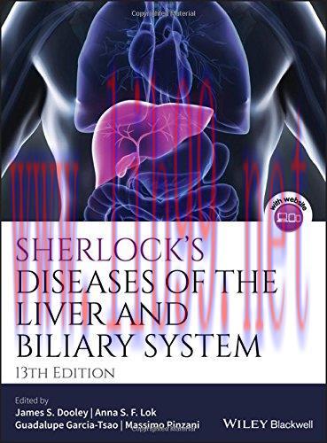 [AME]Sherlock’s Diseases of the Liver and Biliary System, 13ed (PDF)