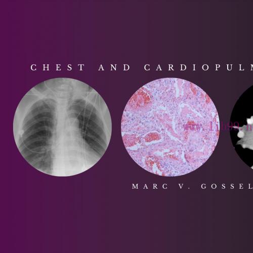 [AME]Chest and Cardiopulmonary Imaging – Marc V. Gosselin, M.D (Videos + PDF)