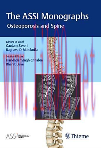 [AME]The ASSI Monographs – Osteoporosis and Spine (Original PDF)