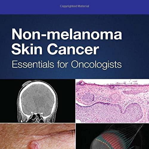 Non-melanoma Skin Cancer: Essentials for Oncologists (Series in Medical Physics and Biomedical Engineering) 1st Edition