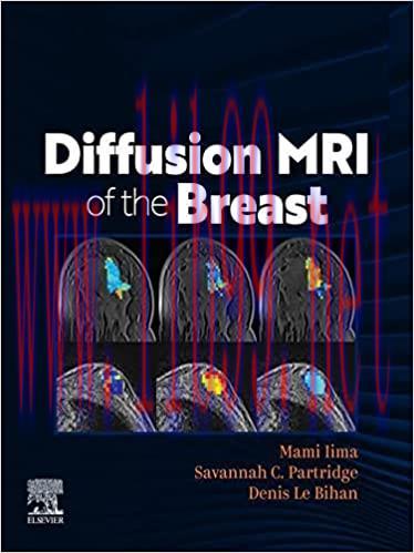 [PDF]DIFFUSION MRI OF THE BREAST