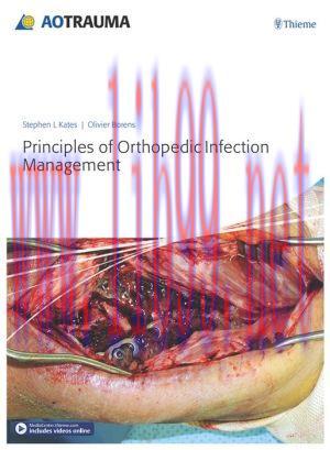 [AME]Principles of Orthopedic Infection Management (PDF) 