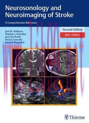 [AME]Neurosonology and Neuroimaging of Stroke: A Comprehensive Reference, 2nd Edition (PDF) 