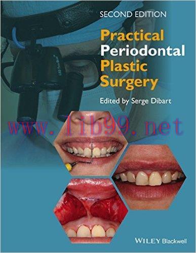 [AME]Practical Periodontal Plastic Surgery, 2nd Edition (ePUB) 