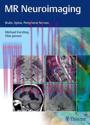 [AME]MR Neuroimaging: Brain, Spine, and Peripheral Nerves (EPUB) 