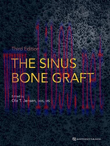 [AME]The Sinus Bone Graft, 3rd Edition 