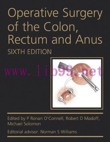 [AME]Operative Surgery of the Colon, Rectum and Anus, 6th Edition (Original PDF) 