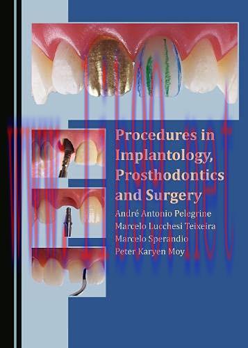 [AME]Procedures in Implantology, Prosthodontics and Surgery (Original PDF) 