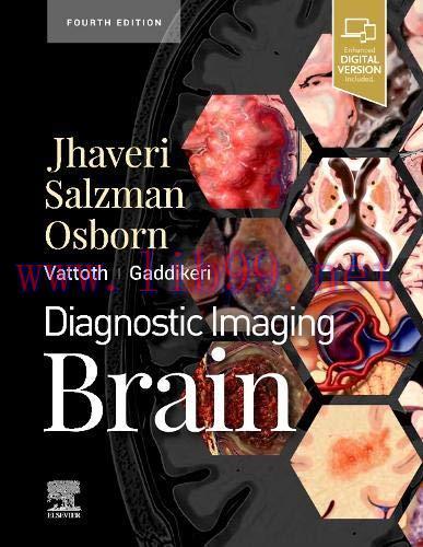 [AME]Diagnostic Imaging: Brain, 4th Edition (Original PDF) 