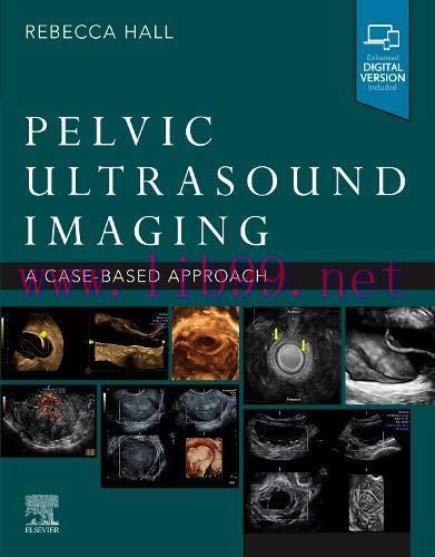[AME]Pelvic Ultrasound Imaging: A Cased-Based Approach (Original PDF+Videos) 