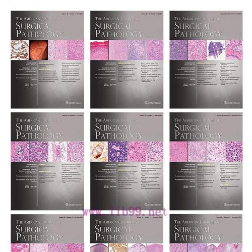 [AME]American Journal of Surgical Pathology 2022 Full Archives (True PDF) 