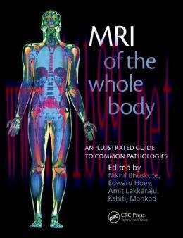[AME]MRI of the Whole Body: An Illustrated Guide for Common Pathologies 