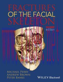 [AME]Fractures of the Facial Skeleton, 2nd Edition 