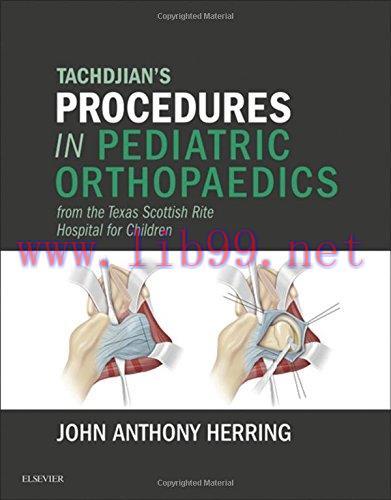 [AME]Tachdjian's Procedures in Pediatric Orthopaedics: From_ the Texas Scottish Rite Hospital for Children (ORIGINAL PDF from_ Publisher) 
