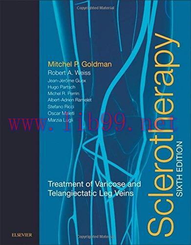 [AME]Sclerotherapy: Treatment of Varicose and Telangiectatic Leg Veins, 6th Edition (Original PDF) 