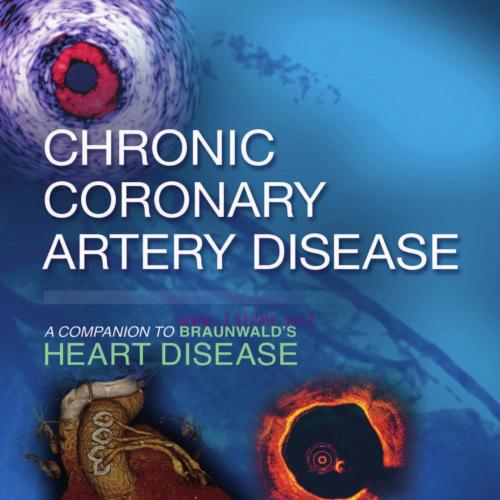 [AME]Chronic Coronary Artery Disease: A Companion to Braunwald’s Heart Disease E-Book 1st Edition (PDF) 
