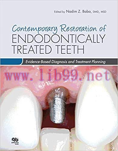 [AME]Contemporary Restoration of Endodontically Treated Teeth: Evidence-Based Diagnosis and Treatment Planning (ORIGINAL PDF from_ Publisher) 